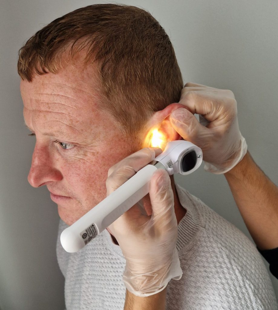 ear wax removal