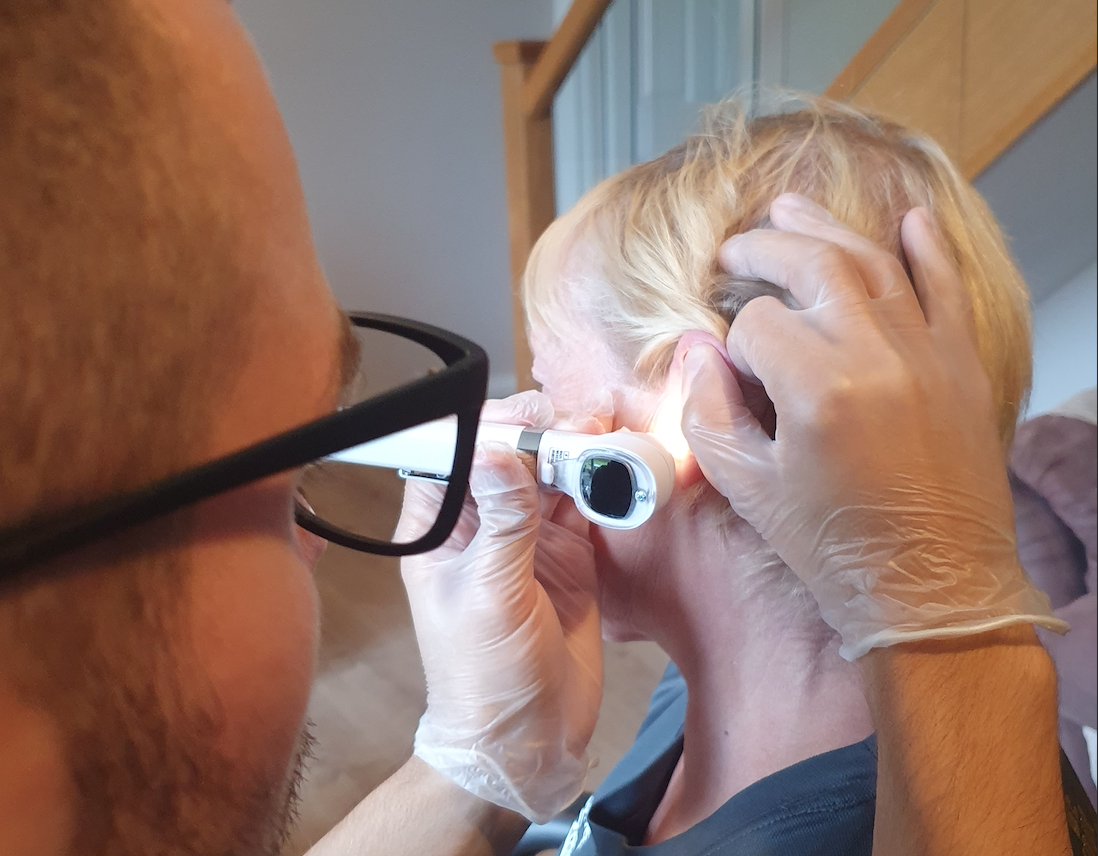 earwax removal
