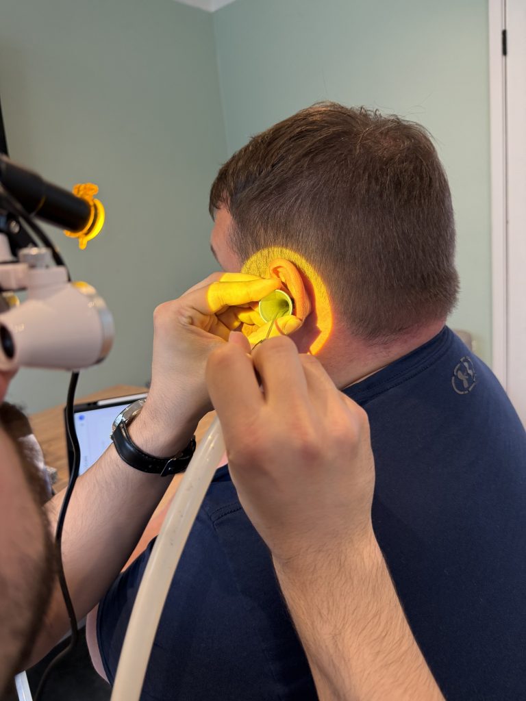 ear wax removal wallsend 