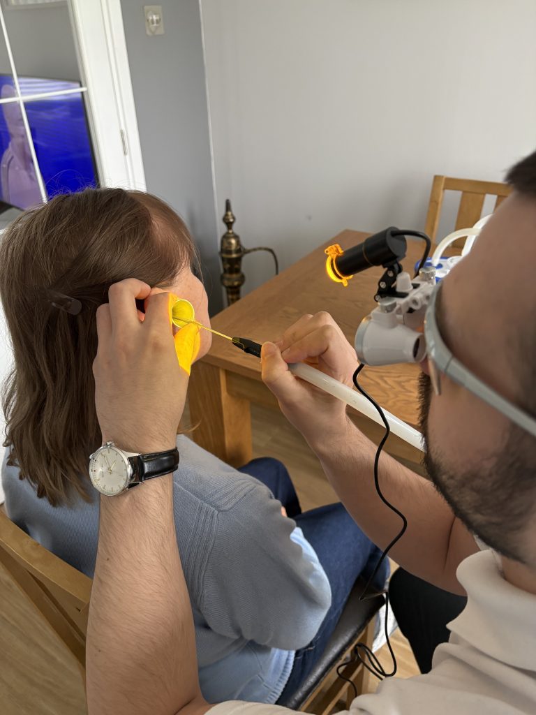 earwax removal