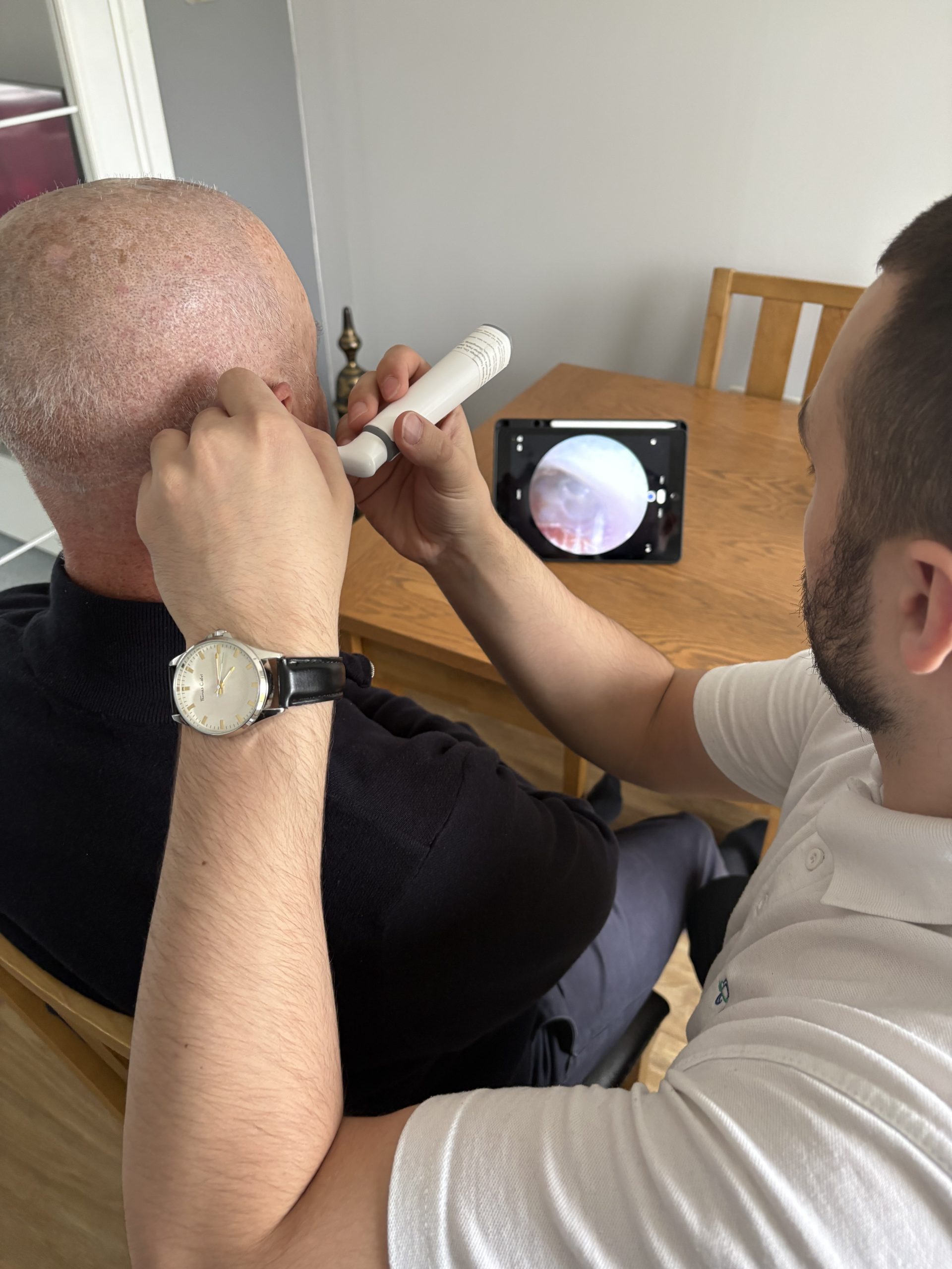 NHS ear wax removal