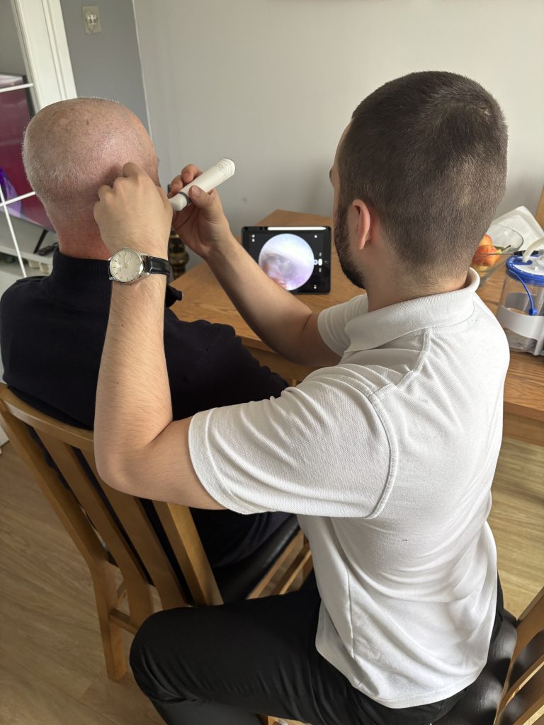 Home visit ear wax removal North Shields earwax removal