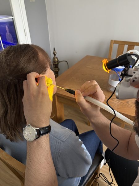 Earluxe microsuction home visit North Tyneside ear wax removal home visits North Tyneside